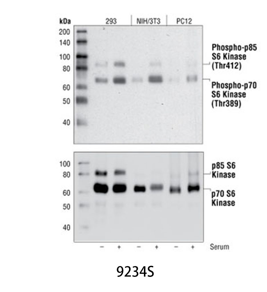 Phospho-p70 S6 Kinase (Thr389) (108D2) Rabbit mAb