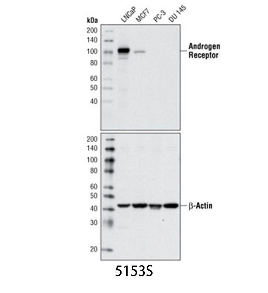 Androgen Receptor (D6F11) XP Rabbit mAb