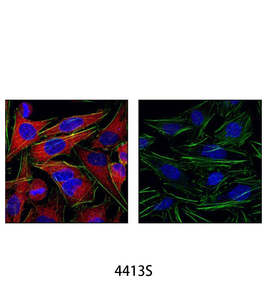 Anti-rabbit IgG (H+L) F(ab')<sub>2</sub> Fragment (Alexa Fluor 555 Conjugate)