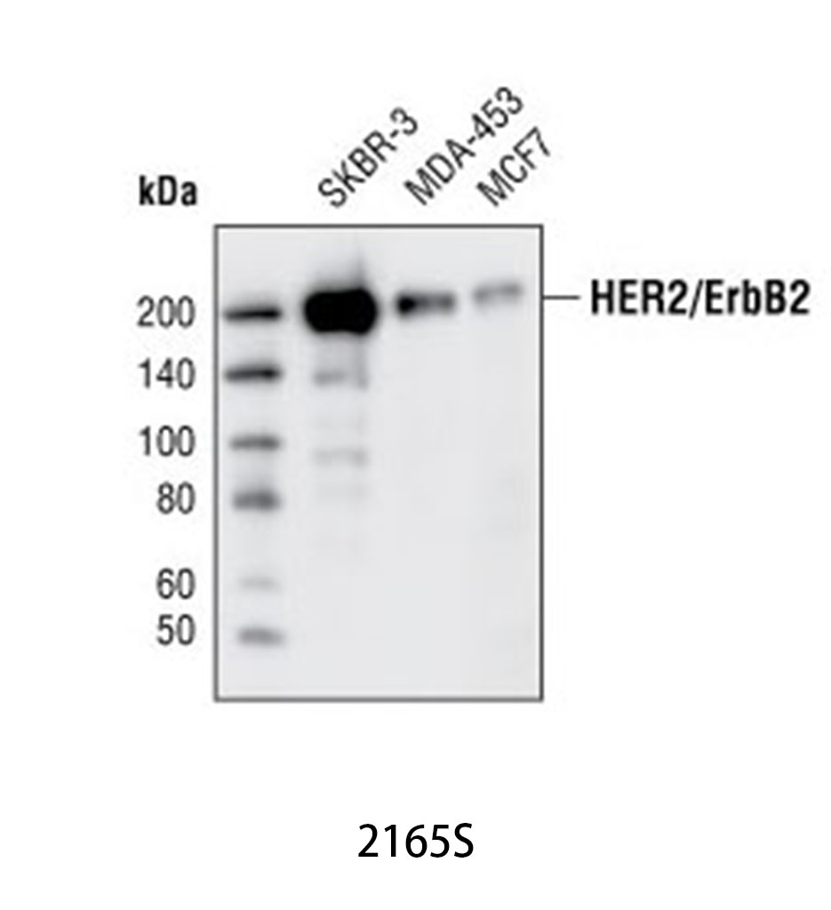 HER2/ErbB2 (29D8) Rabbit mAb