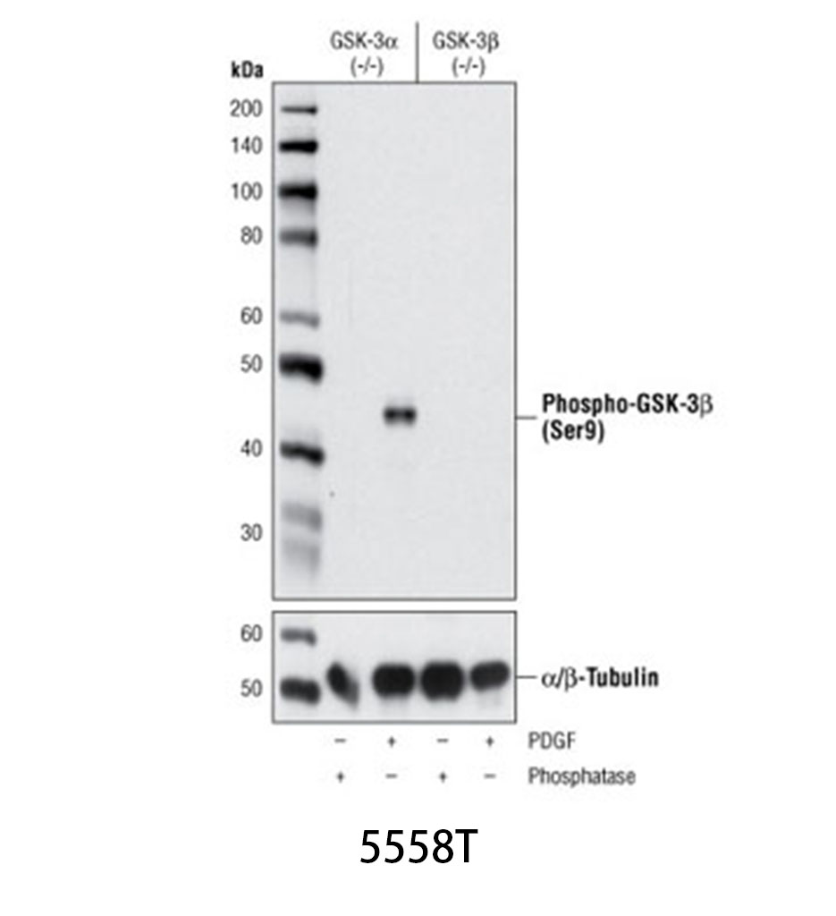 Phospho-GSK-3β (Ser9) (D85E12) XP Rabbit mAb