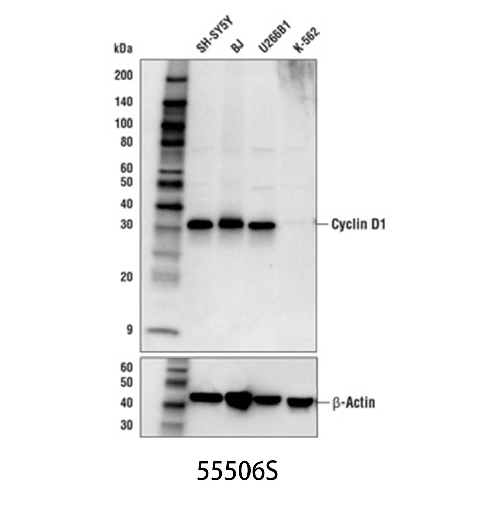 Cyclin D1 (E3P5S) XP Rabbit mAb