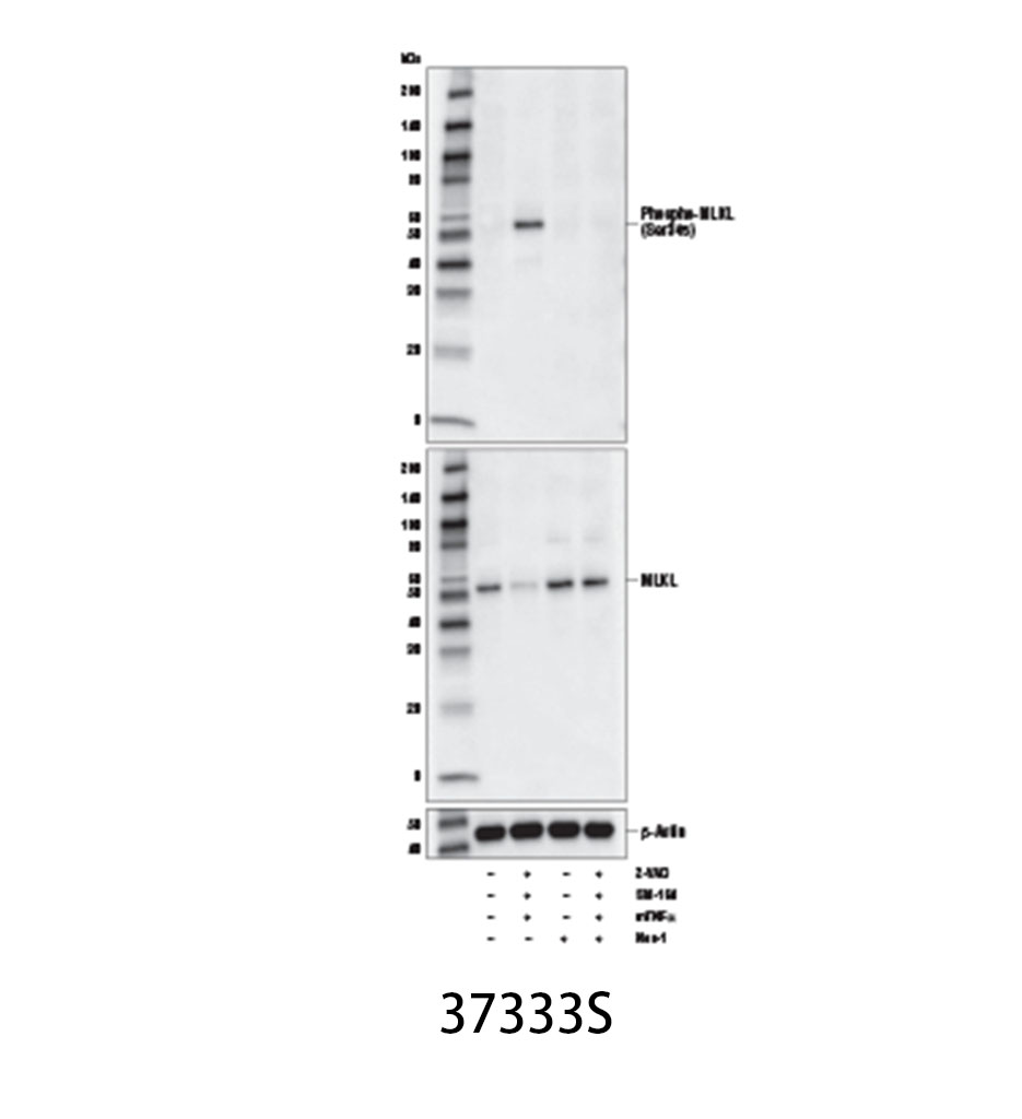 Phospho-MLKL (Ser345) (D6E3G) Rabbit mAb