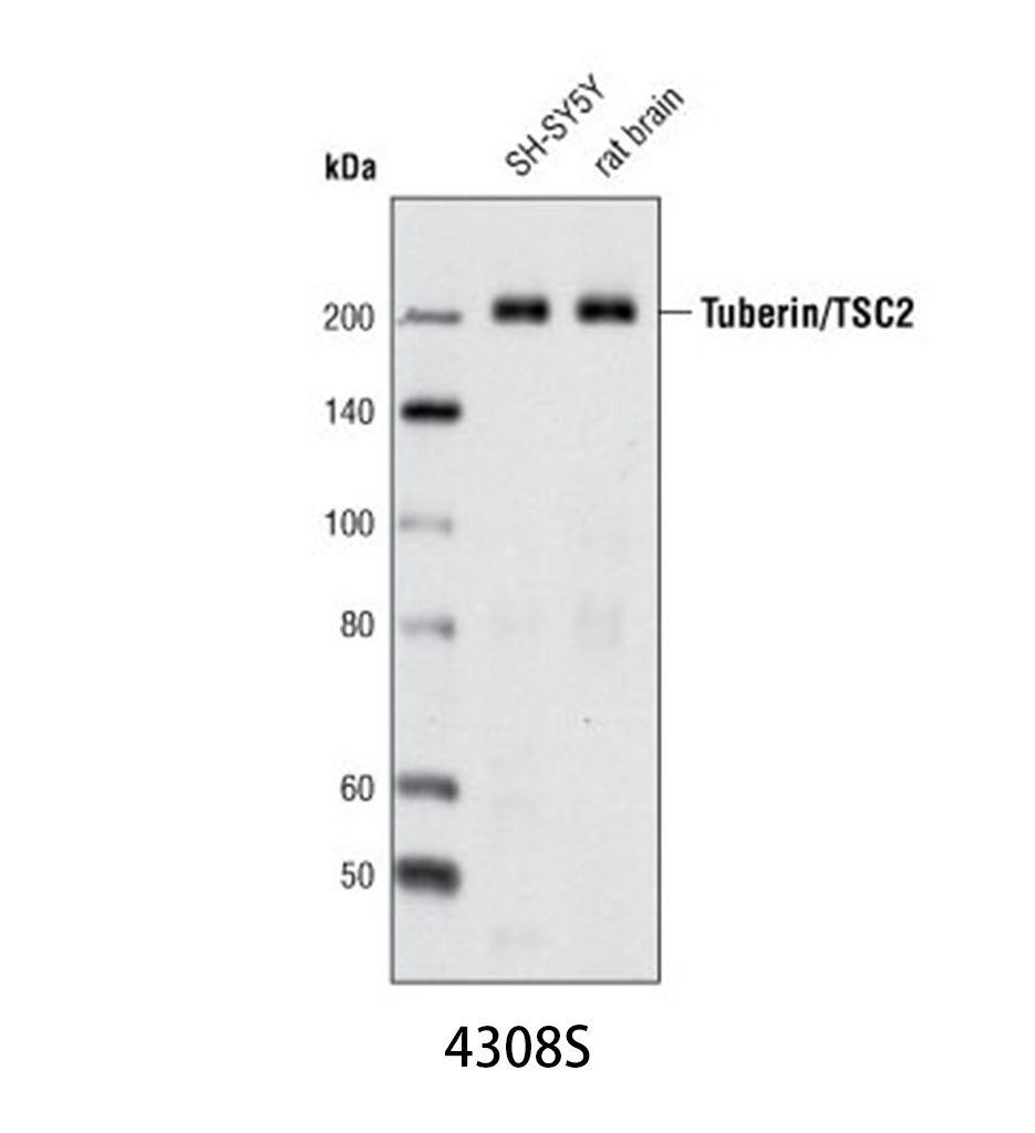 Tuberin/TSC2 (D93F12) XP Rabbit mAb
