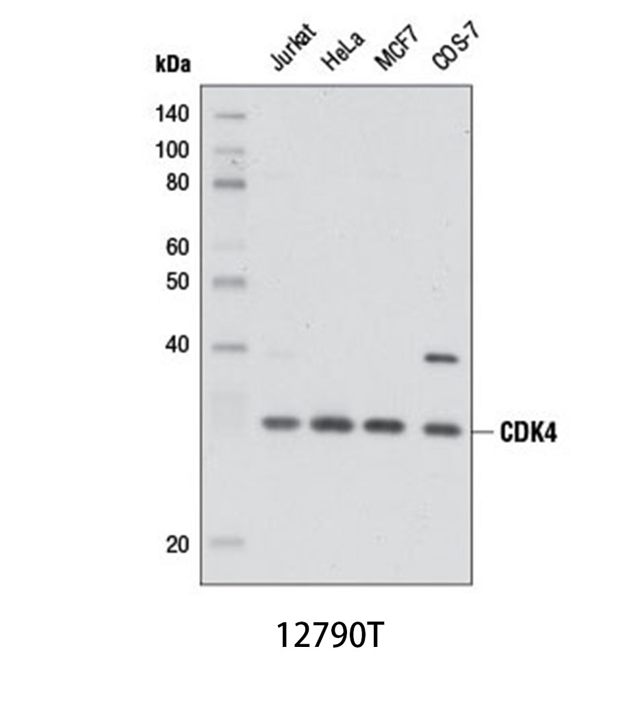 CDK4 (D9G3E) Rabbit mAb