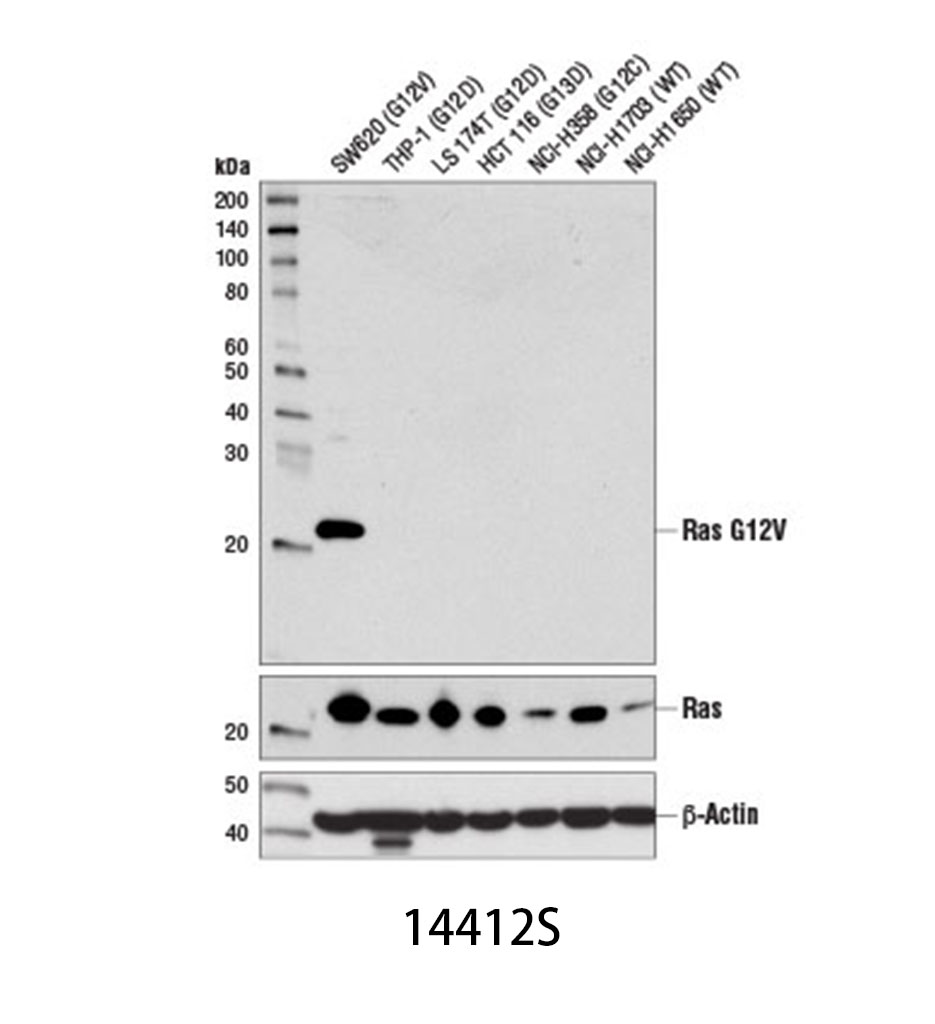 Ras (G12V Mutant Specific) (D2H12) Rabbit mAb