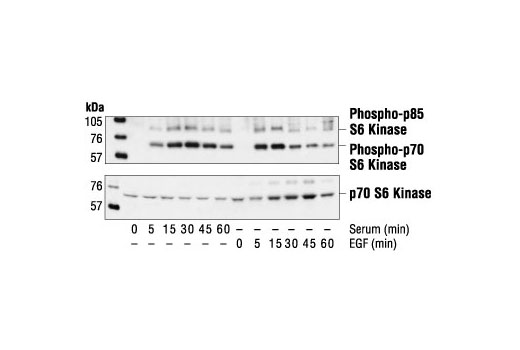 Phospho-p70 S6 Kinase (Thr421/Ser424) Antibody