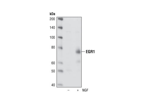 EGR1 (15F7) Rabbit mAb
