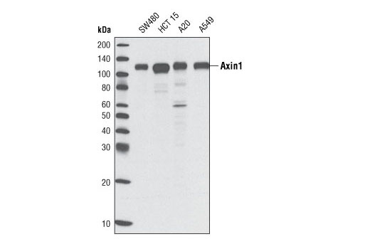 Axin1 (C76H11) Rabbit mAb