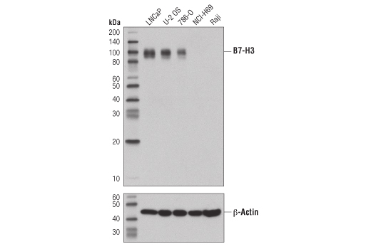 B7-H3 (D9M2L) XP Rabbit mAb