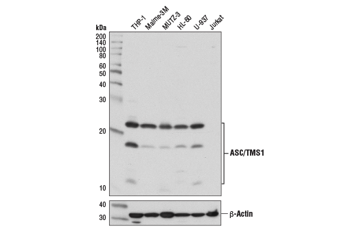 ASC/TMS1 (E1E3I) Rabbit mAb