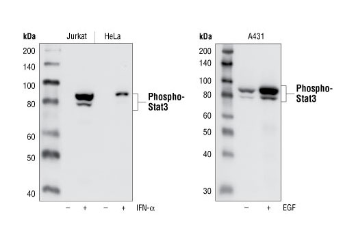 Phospho-Stat3 (Tyr705) (D3A7) XP Rabbit mAb