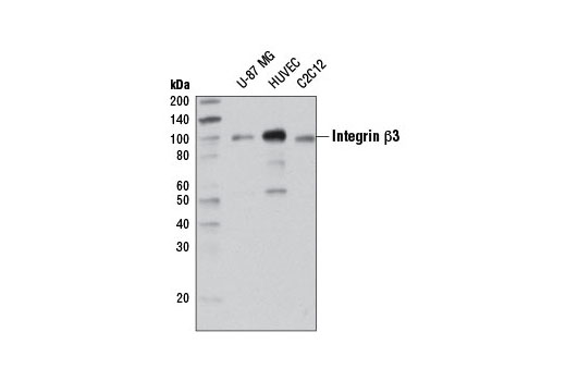 Integrin β3 (D7X3P) XP Rabbit mAb