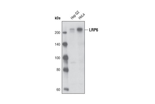 LRP6 (C47E12) Rabbit mAb