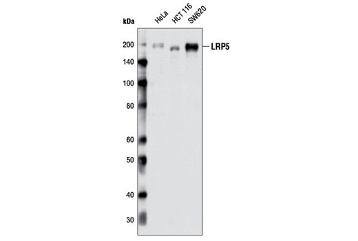 LRP5 (D80F2) Rabbit mAb