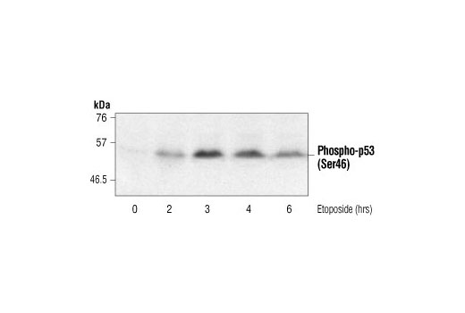 Phospho-p53 (Ser46) Antibody