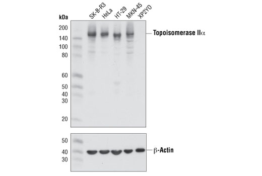 Topoisomerase IIα (D10G9) XP Rabbit mAb