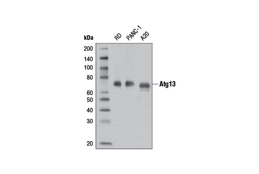 ULK1 Substrate Antibody Sampler Kit
