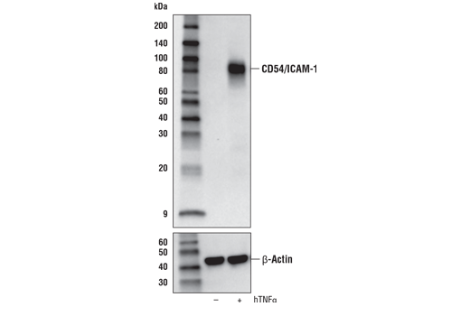 CD54/ICAM-1 (E3Q9N) XP Rabbit mAb
