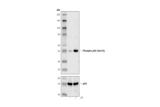 Phospho-p53 (Ser15) (16G8) Mouse mAb