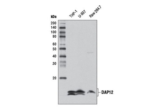DAP12 (D7G1X) Rabbit mAb