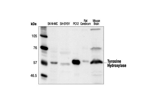 Tyrosine Hydroxylase Antibody