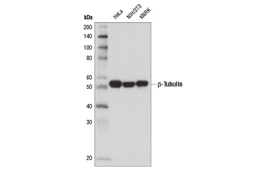 β-Tubulin (D2N5G) Rabbit mAb