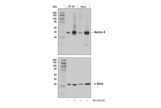 Aurora A (D3V7T) XP Rabbit mAb