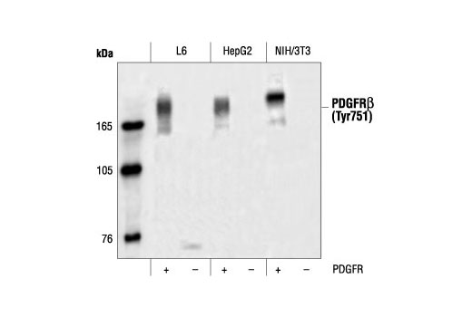 Phospho-PDGF Receptor β (Tyr751) Antibody