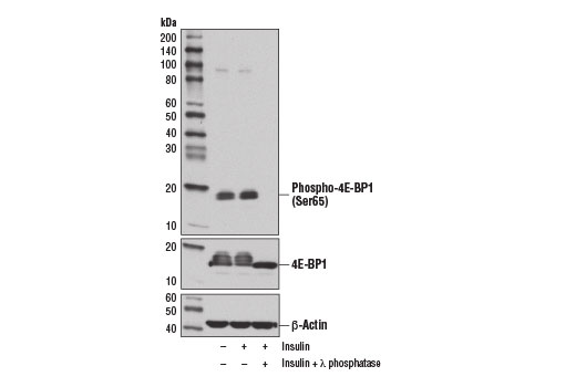 Phospho-4E-BP1 (Ser65) (D9G1Q) Rabbit mAb