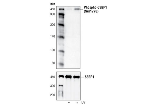 Phospho-53BP1 (Ser1778) Antibody