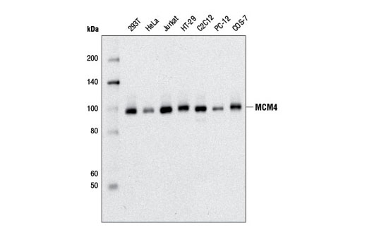 MCM4 (D3H6N) XP Rabbit mAb