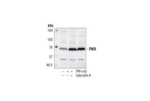 PKR Antibody