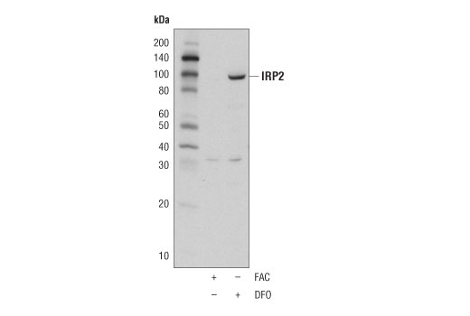 IRP2 (D6E6W) Rabbit mAb
