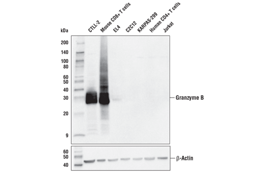 Granzyme B (E5V2L) Rabbit mAb (Mouse Specific)
