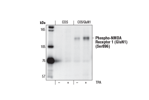 Phospho-NMDA Receptor 1 (GluN1) (Ser896) Antibody