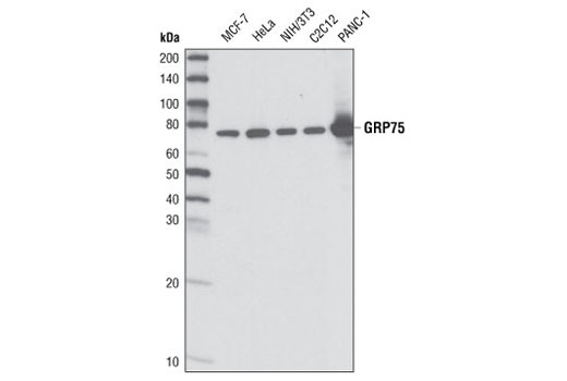 Grp75 (D13H4) XP Rabbit mAb