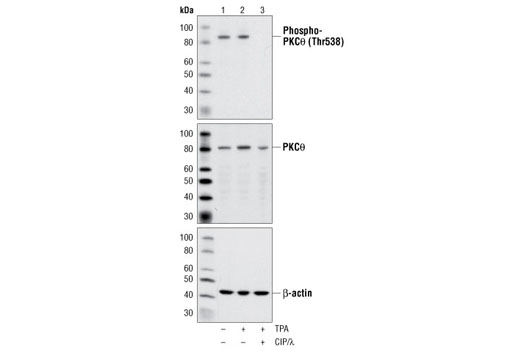 Phospho-PKCθ (Thr538) Antibody