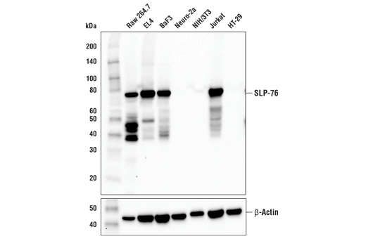 SLP-76 (E4N7E) Rabbit mAb