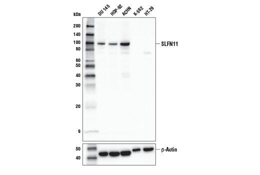 SLFN11 (D8W1B) Rabbit mAb