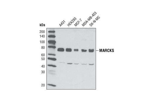 MARCKS (D88D11) XP Rabbit mAb