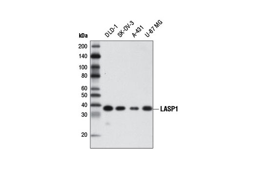 LASP1 Antibody