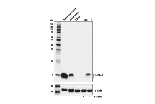 S100A8 (E4F8V) XP Rabbit mAb