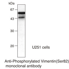 Anti-Phosphorylated Vimentin (Ser82) mAb
