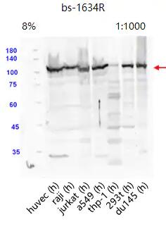 Anti-ATF6 antibody