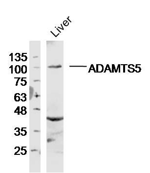 软骨蛋白聚糖抗体