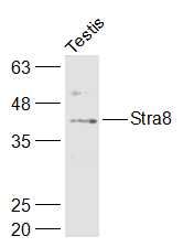 视黄酸激活基因8抗体