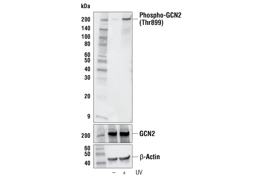 Phospho-GCN2 (Thr899) (E1V9M) Rabbit mAb