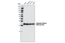 Ubiquityl-Histone H2B (Lys120) (D11) XP Rabbit mAb