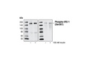 IRS-1 Inhibition Antibody Sampler Kit